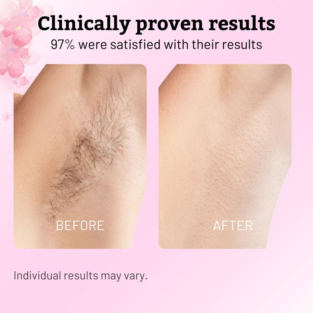 Cyperus Rotundus Hair Inhibitor Oil