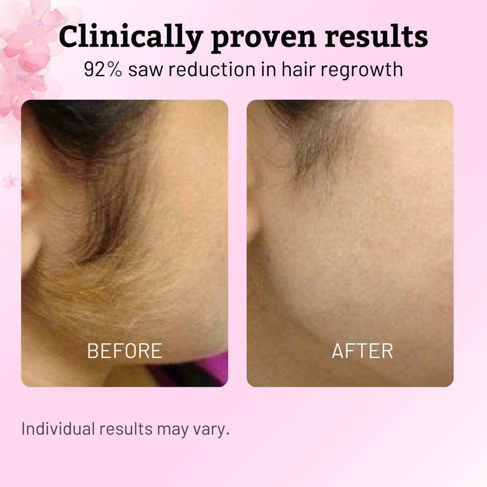 Cyperus Rotundus Hair Inhibitor Oil